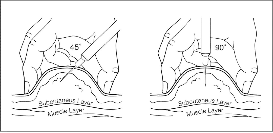 How to inject semaglutide video and instructions bmi doctors