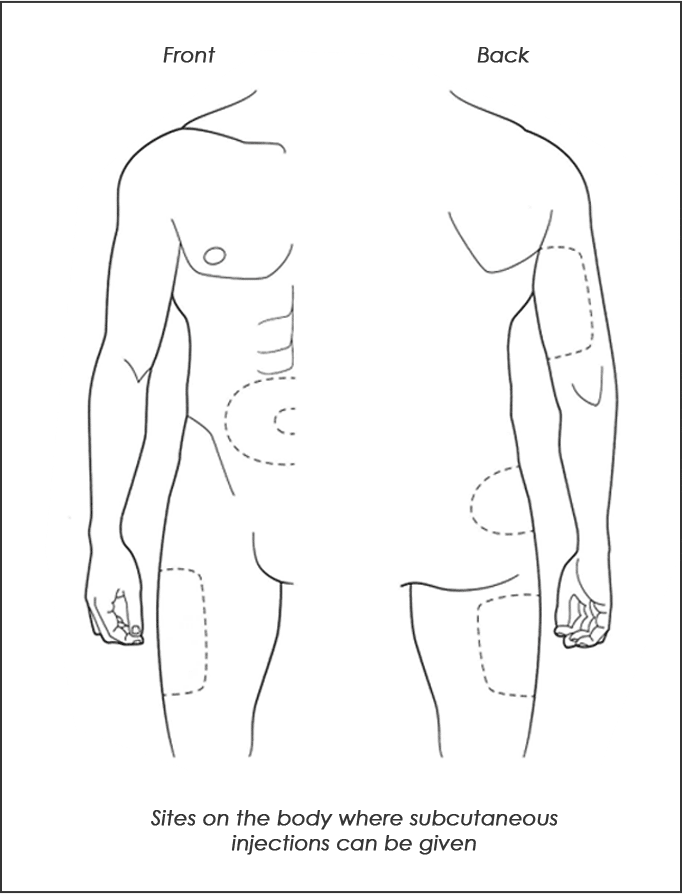 Sites on the body that are safe to give subcutaneous shots.