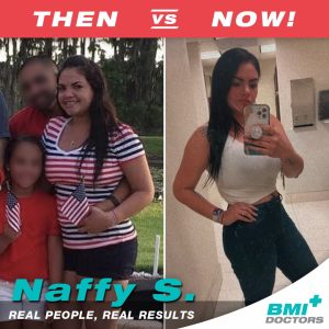 bmi-before-after-naffy