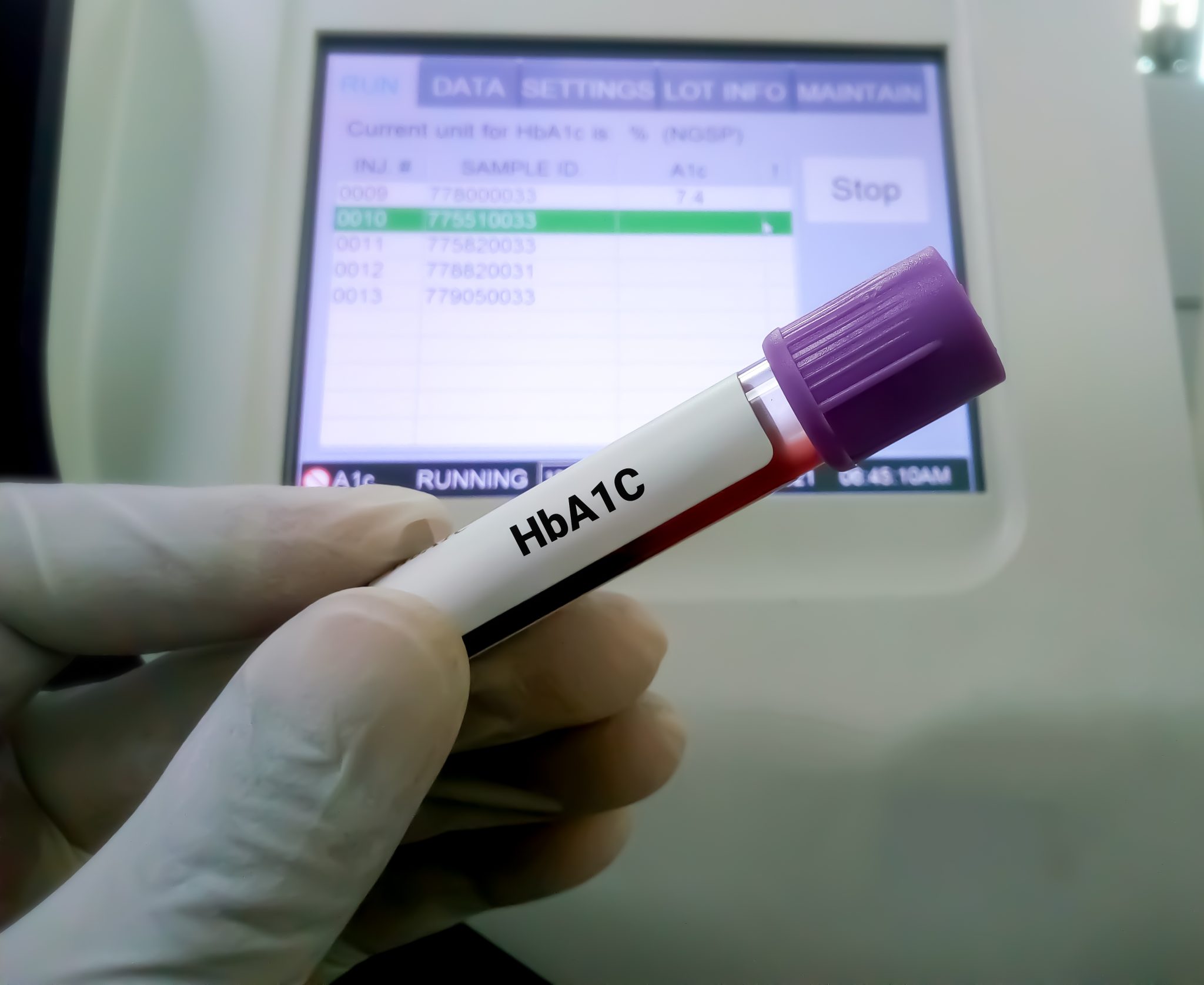 hemoglobin-a1c-hba1c-test