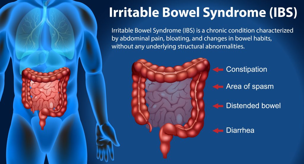 ibs and semaglutide graphic