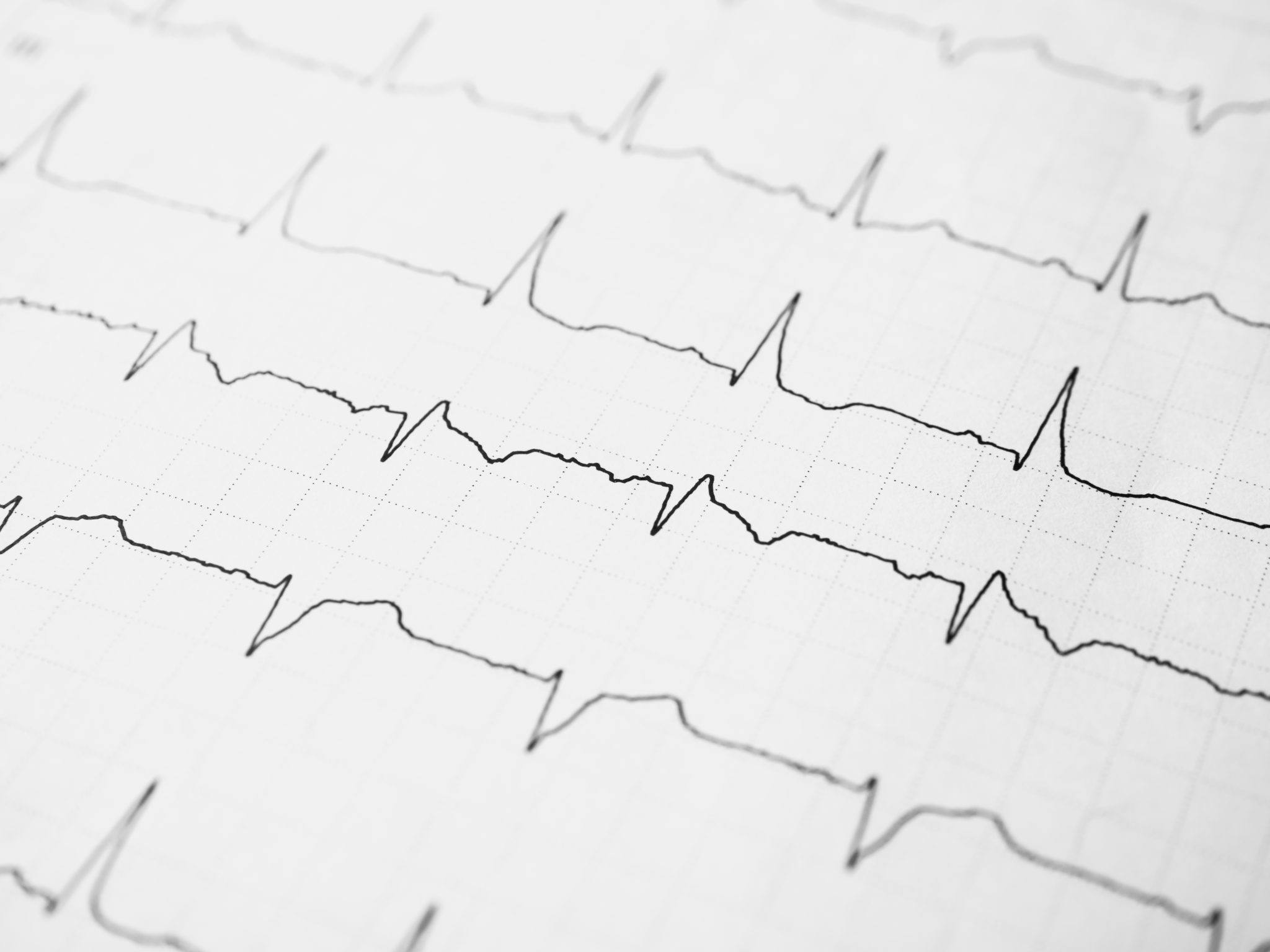 semaglutide and afib 1