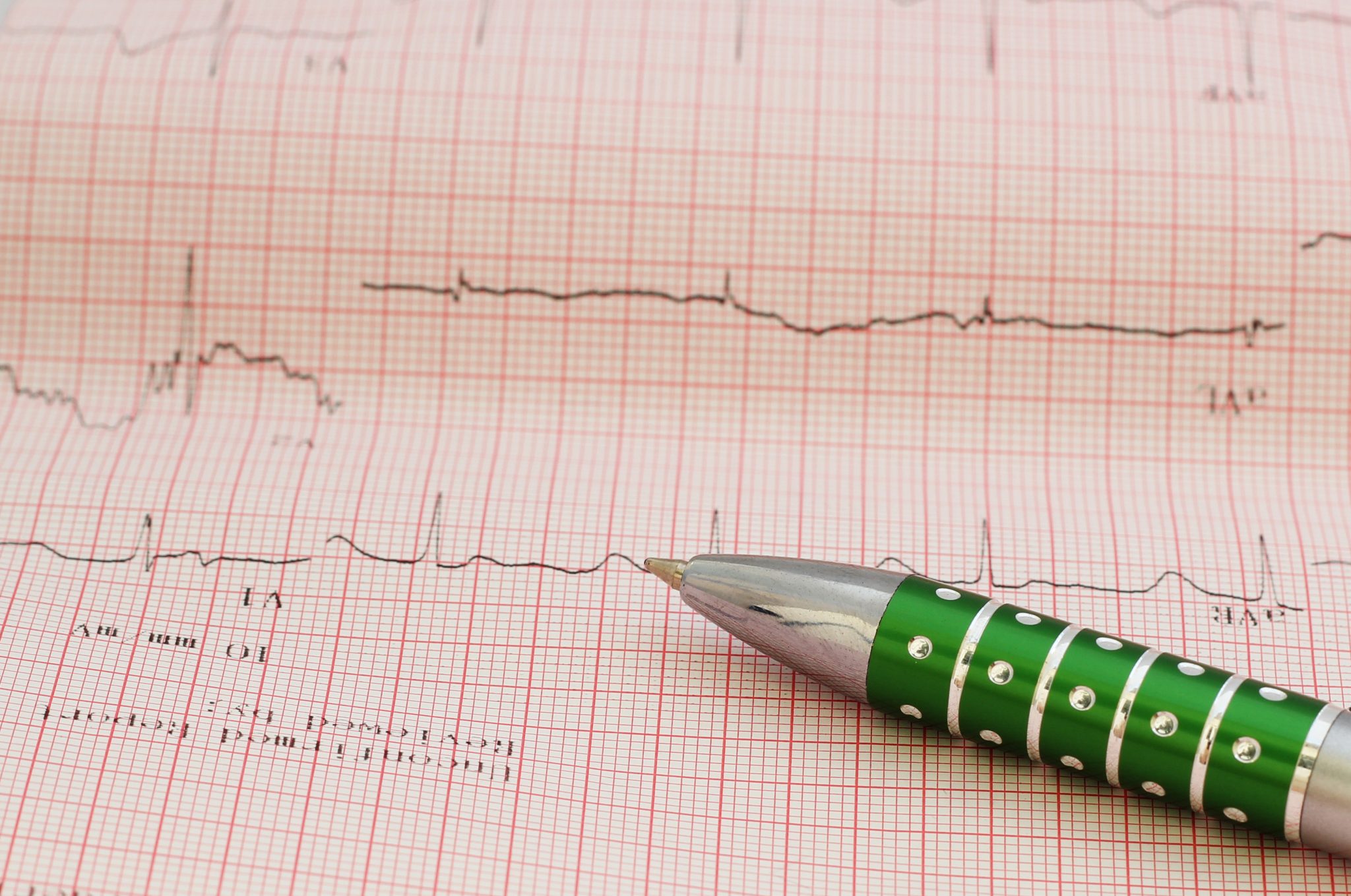 semaglutide and afib 4