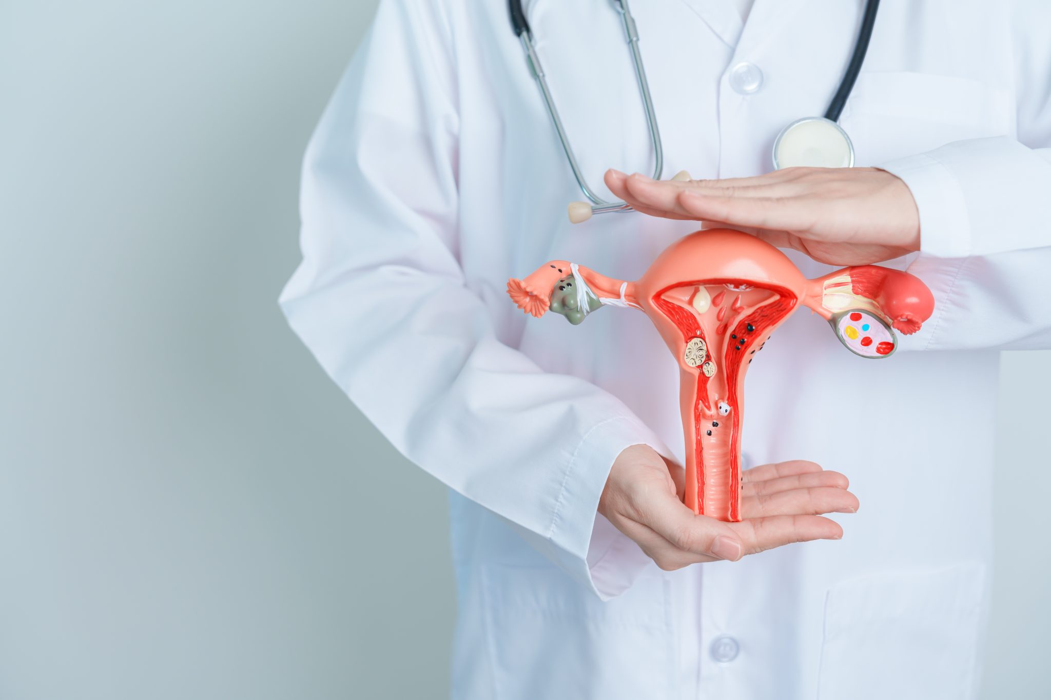 semaglutide and fibroids 4