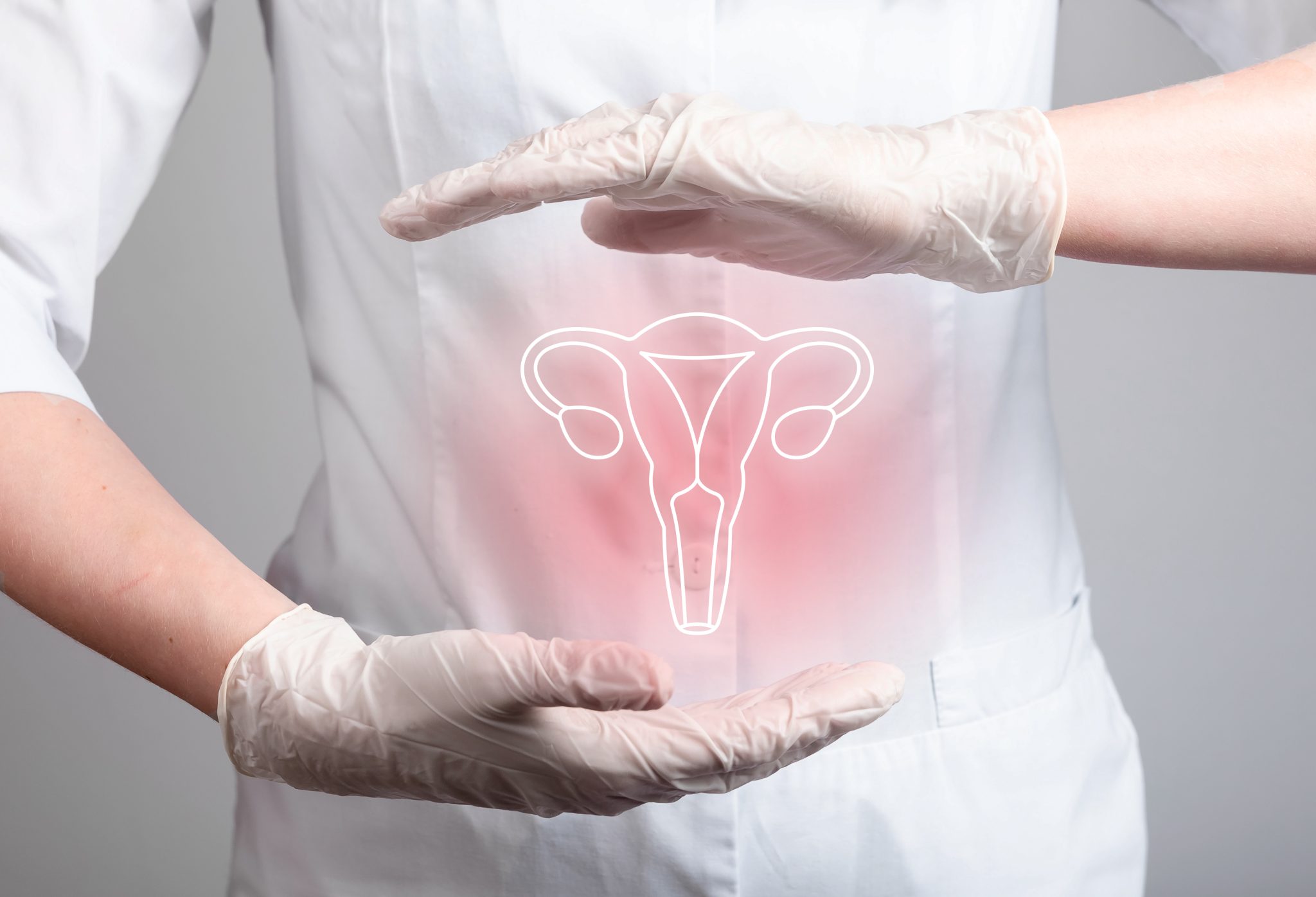 Endometriosis and semaglutide 3
