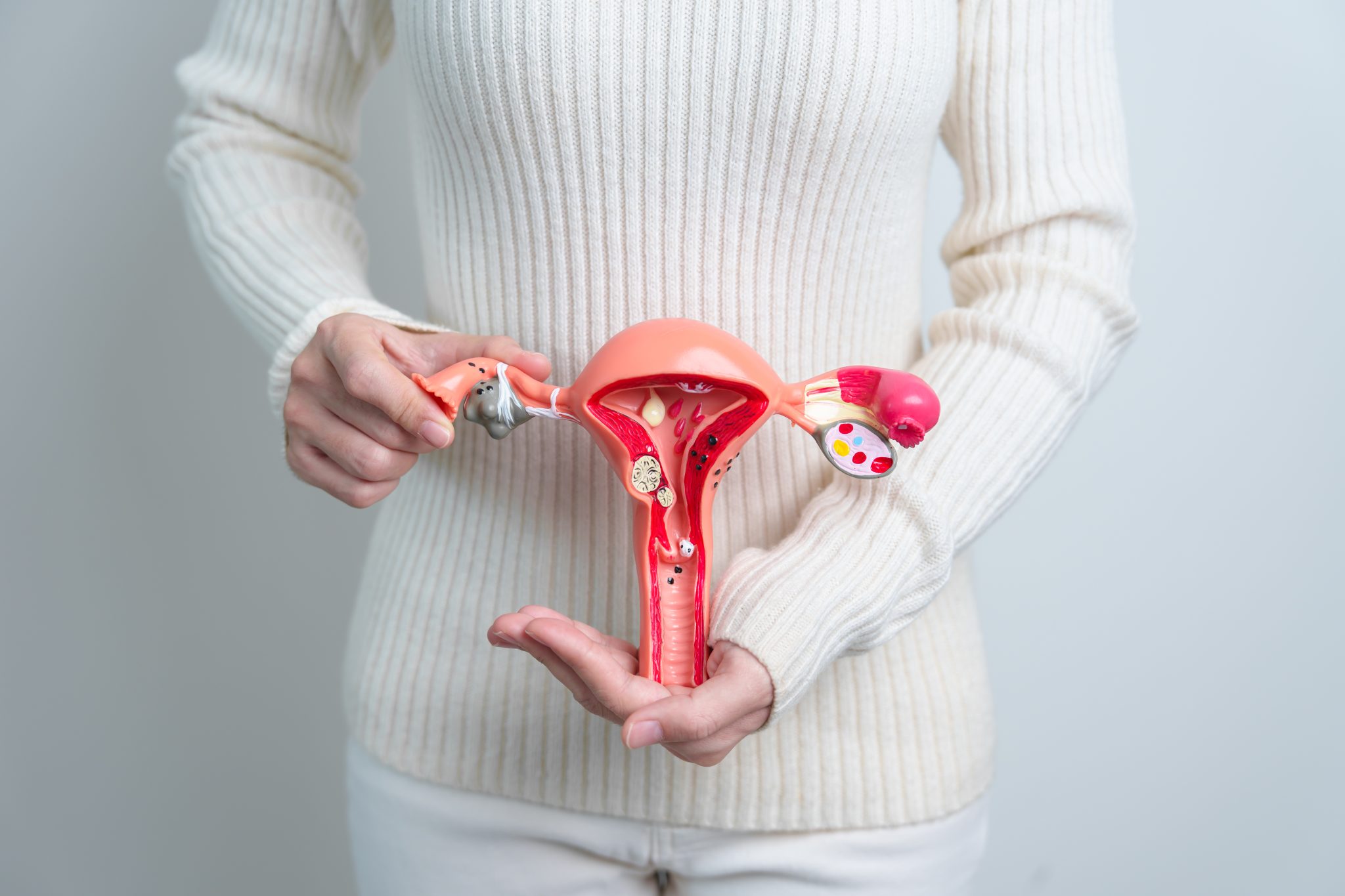 Endometriosis and semaglutide 4