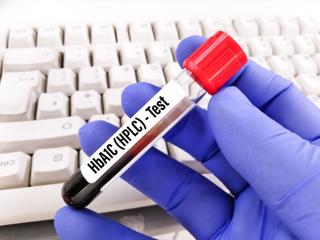 how to lower a1c naturally 1