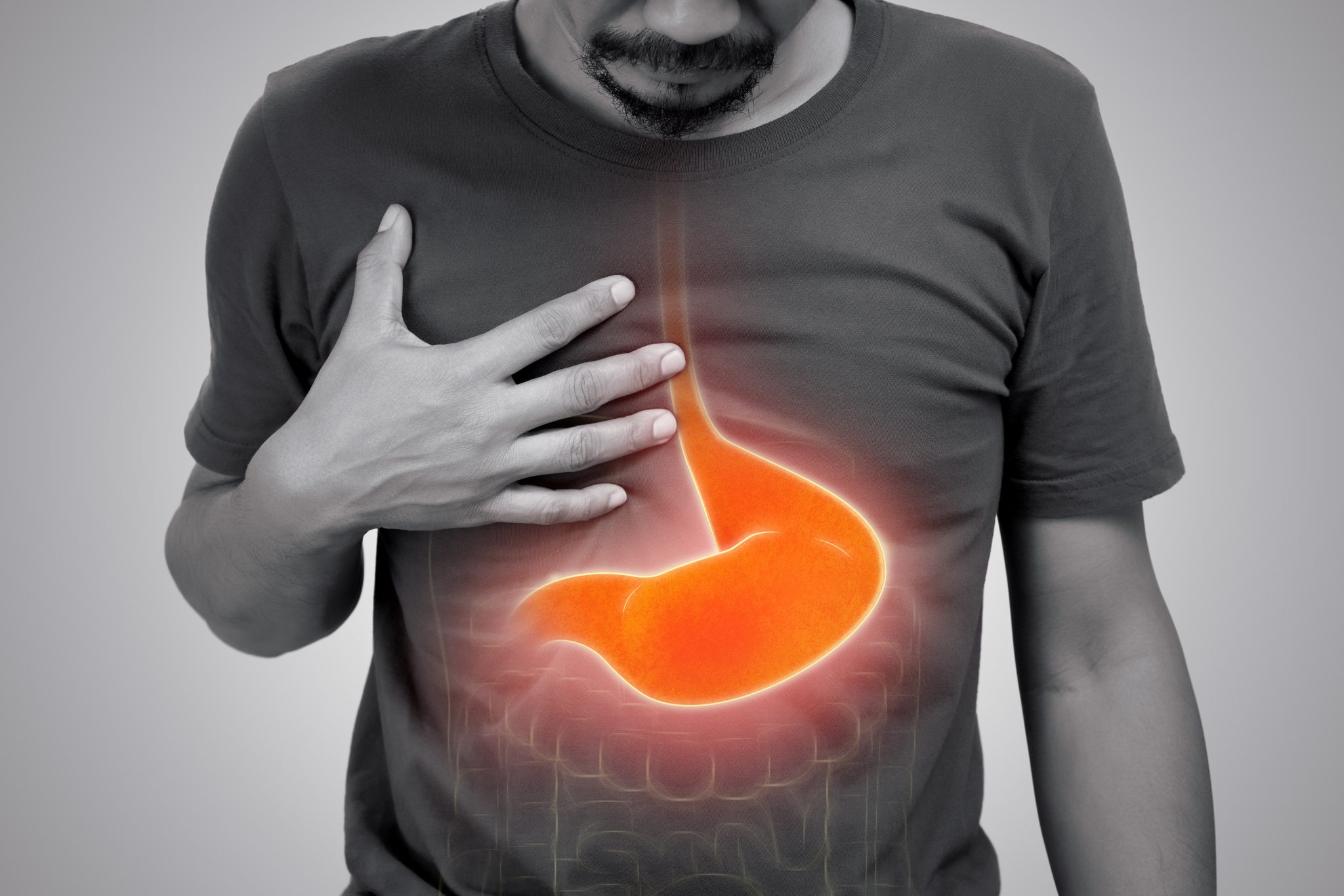 semaglutide and GERD 3