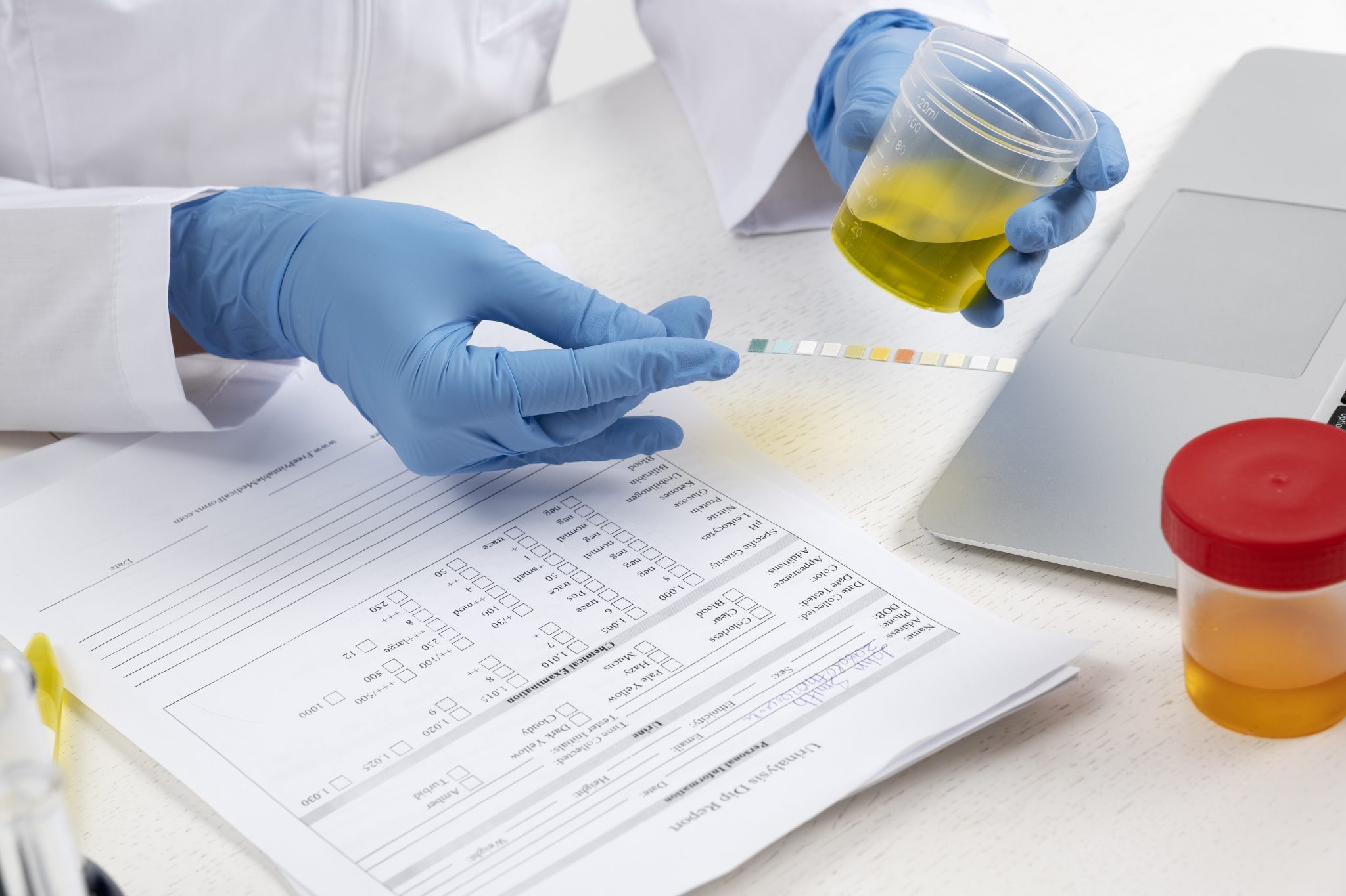 will semaglutide show on a drug test 4