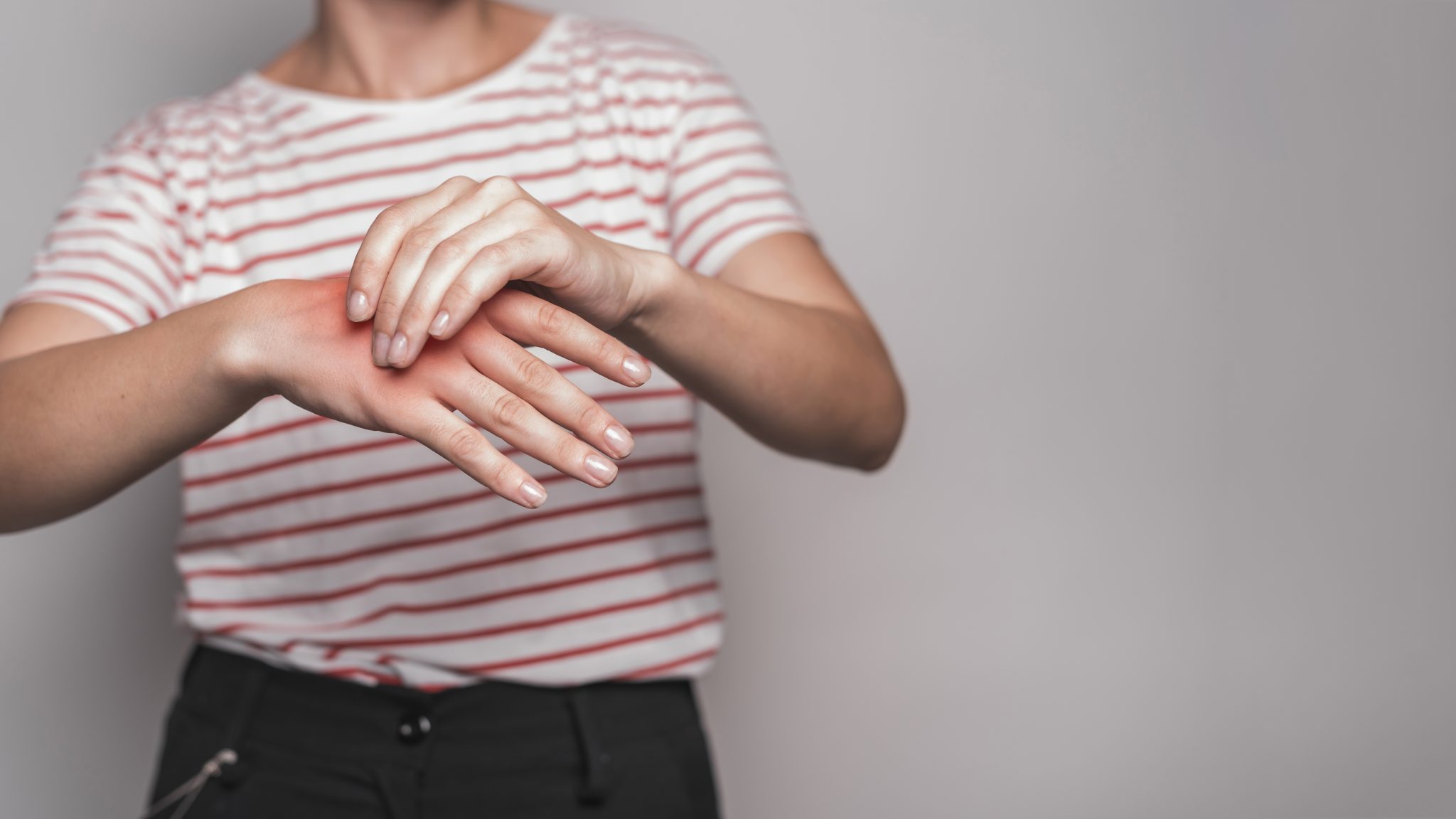 Chronic Dermatitis and semaglutide 2