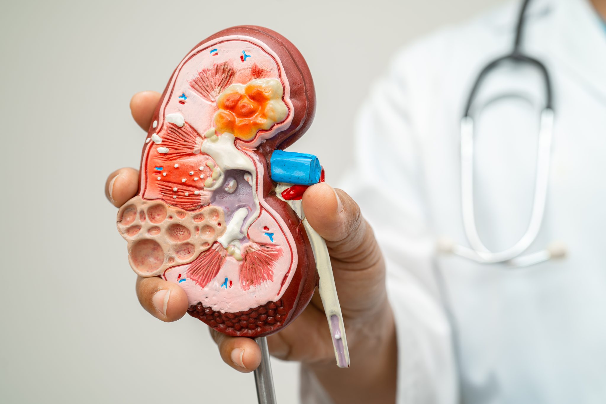 Chronic Kidney Disease and semaglutide 1