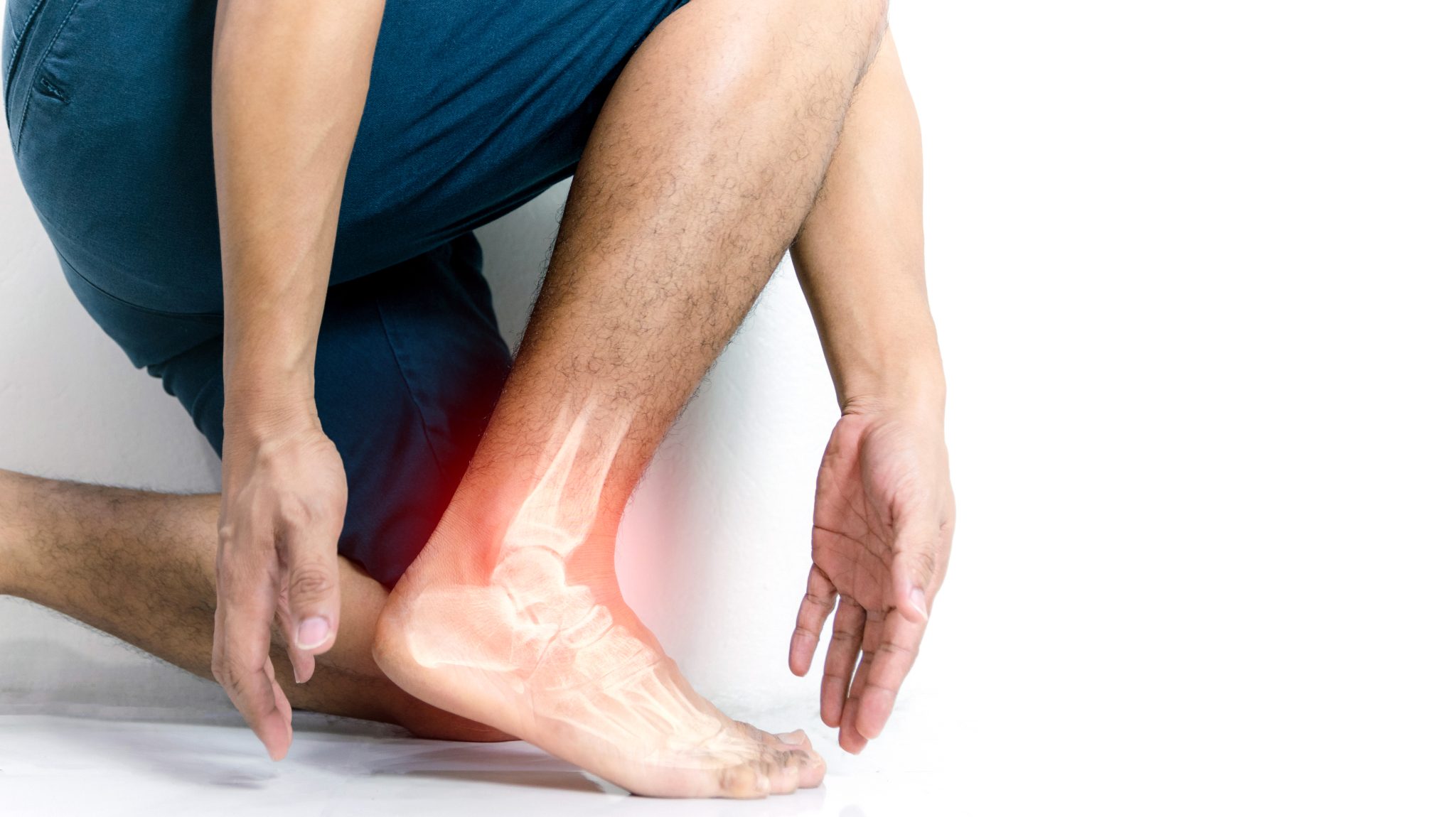 Gout and semaglutide 3