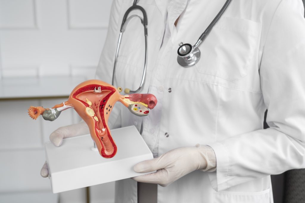 semaglutide and ovarian cancer 1