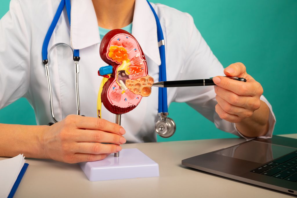 tirzepatide kidney damage 1