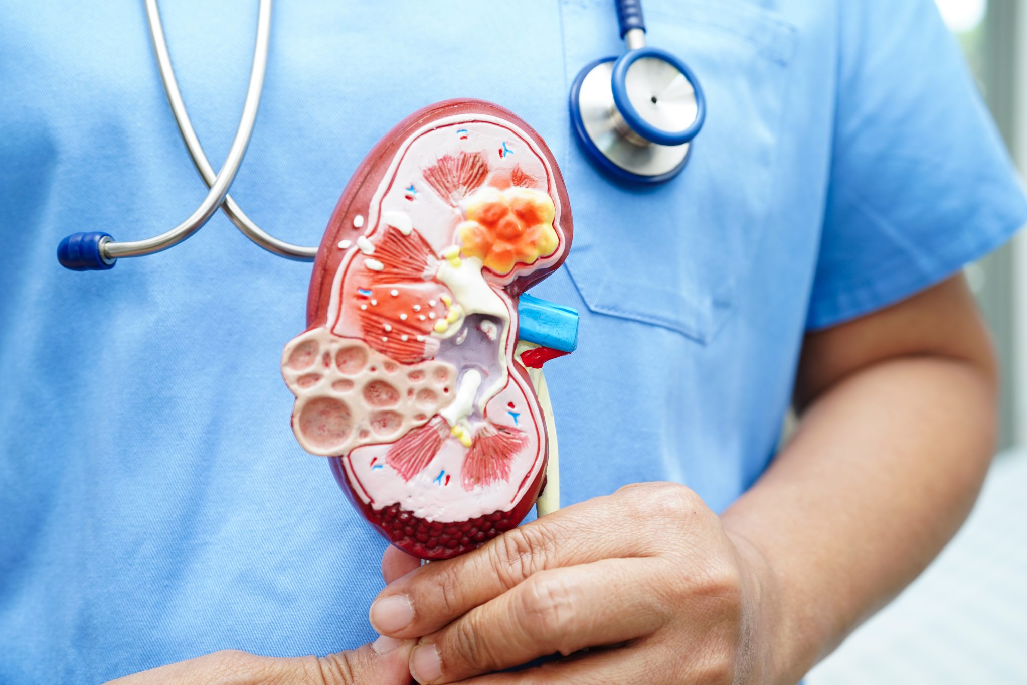 tirzepatide side effects kidney 4