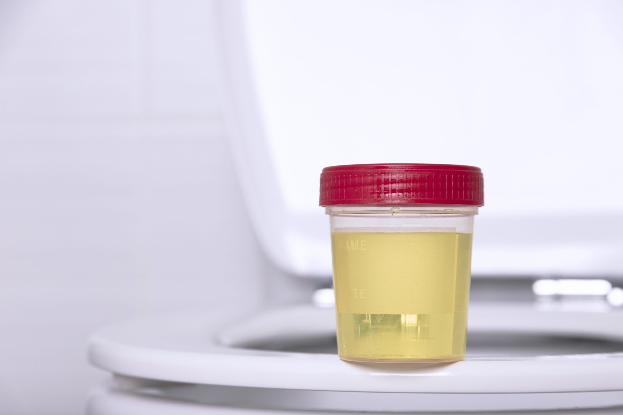 semaglutide and urine odor 3