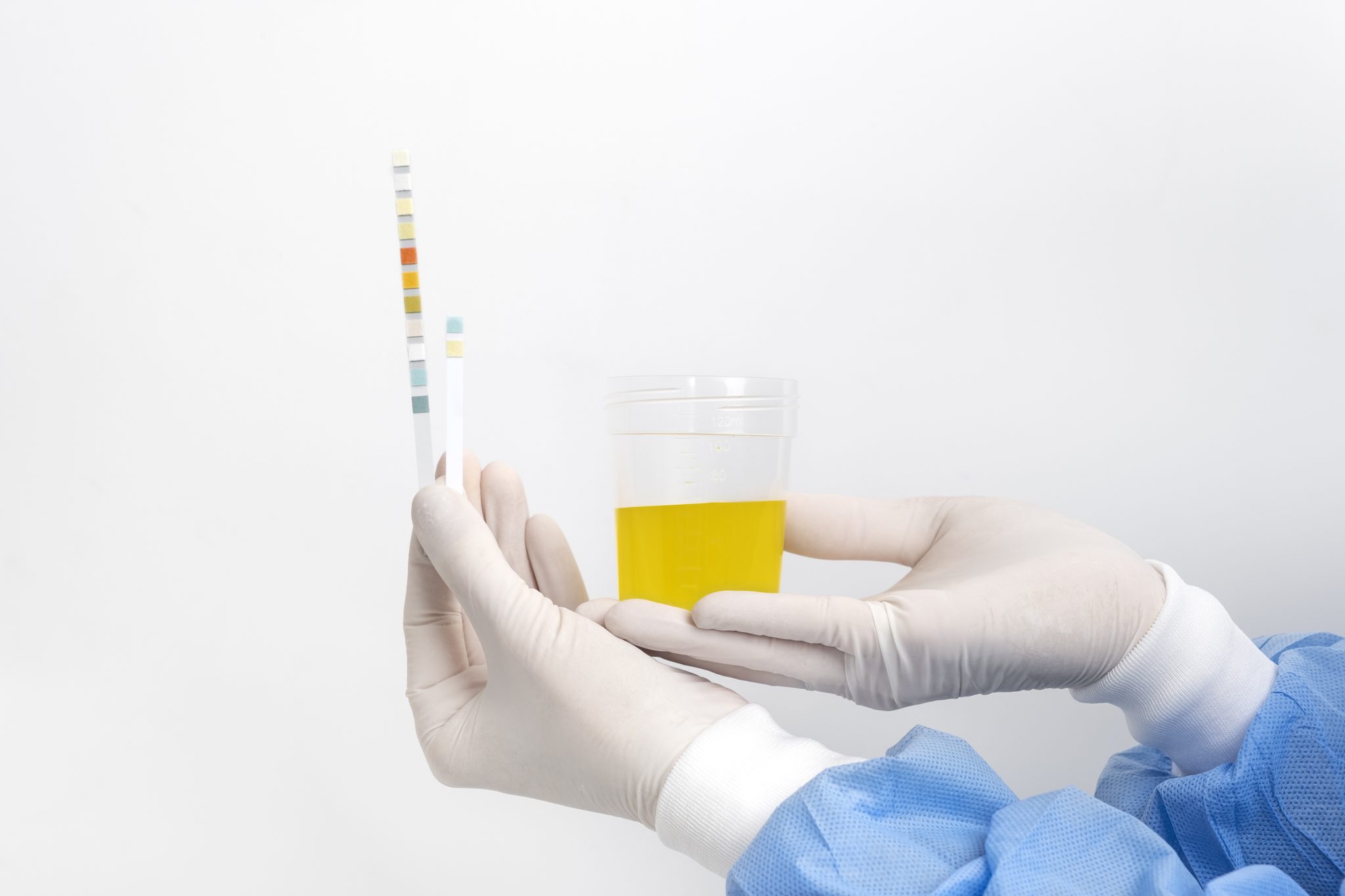 will tirzepatide fail a drug test 2