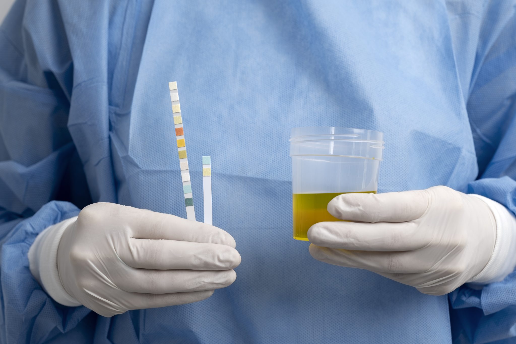 will tirzepatide fail a drug test 4