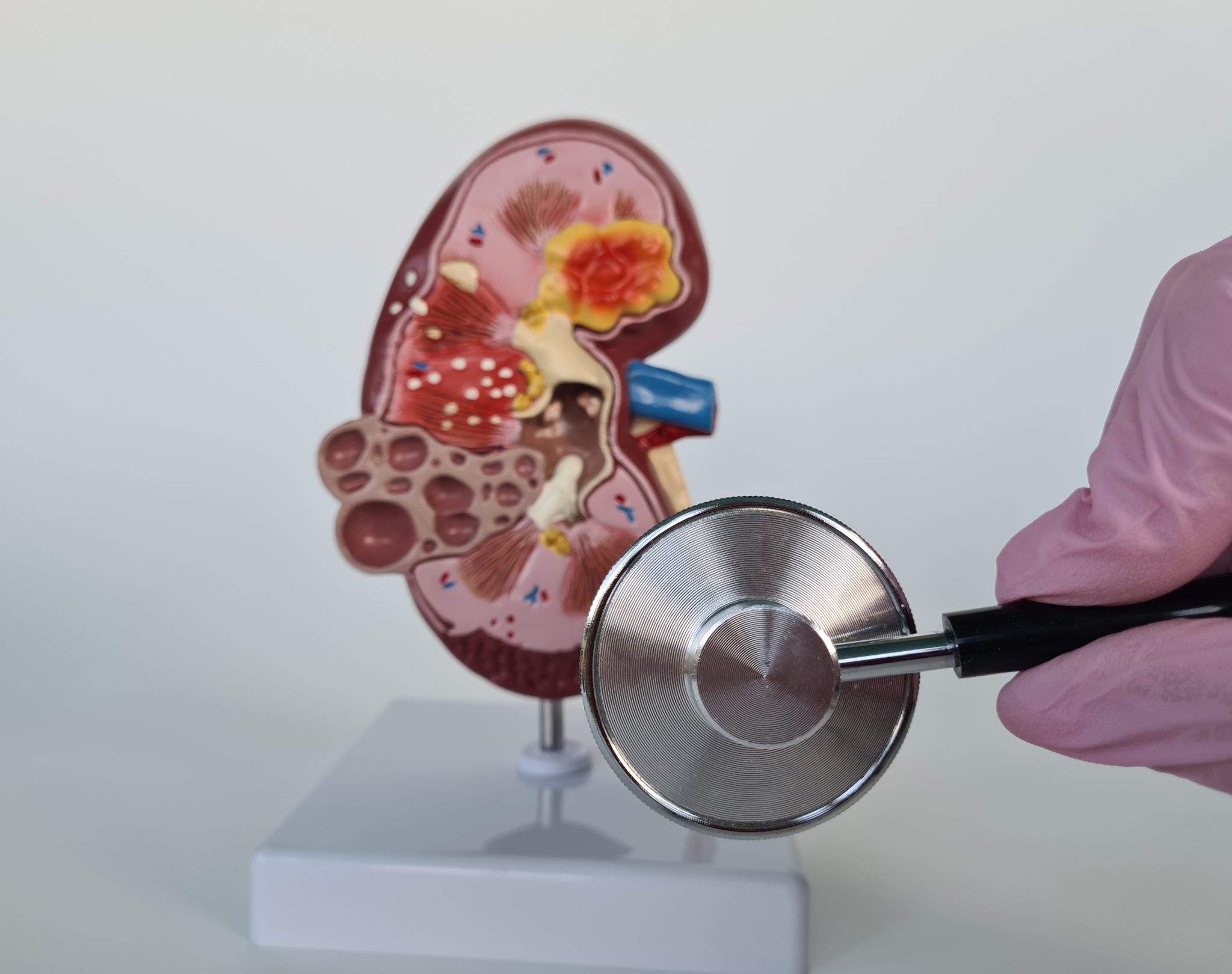 tirzepatide kidney 4