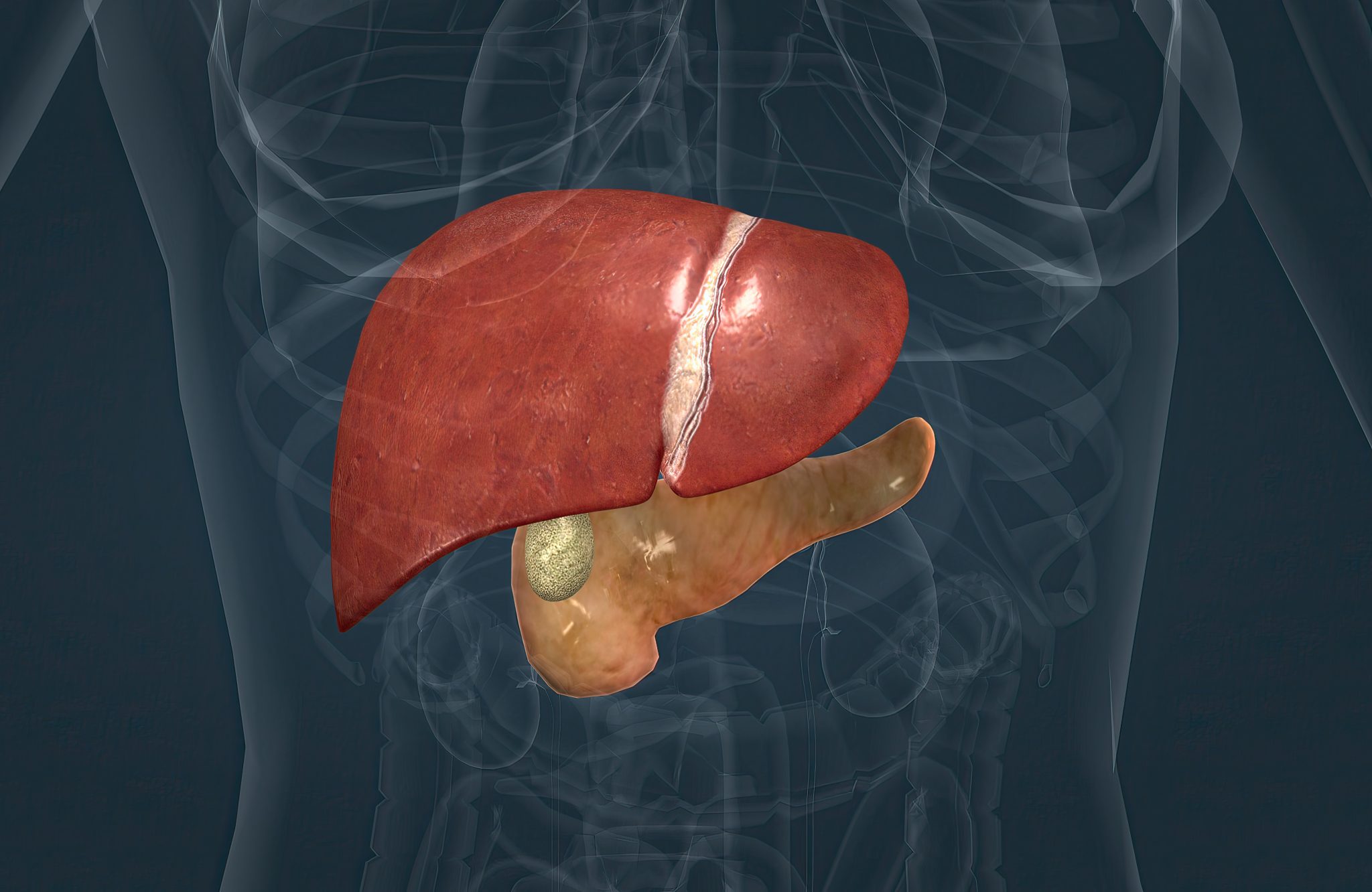 tirzepatide fatty liver 2