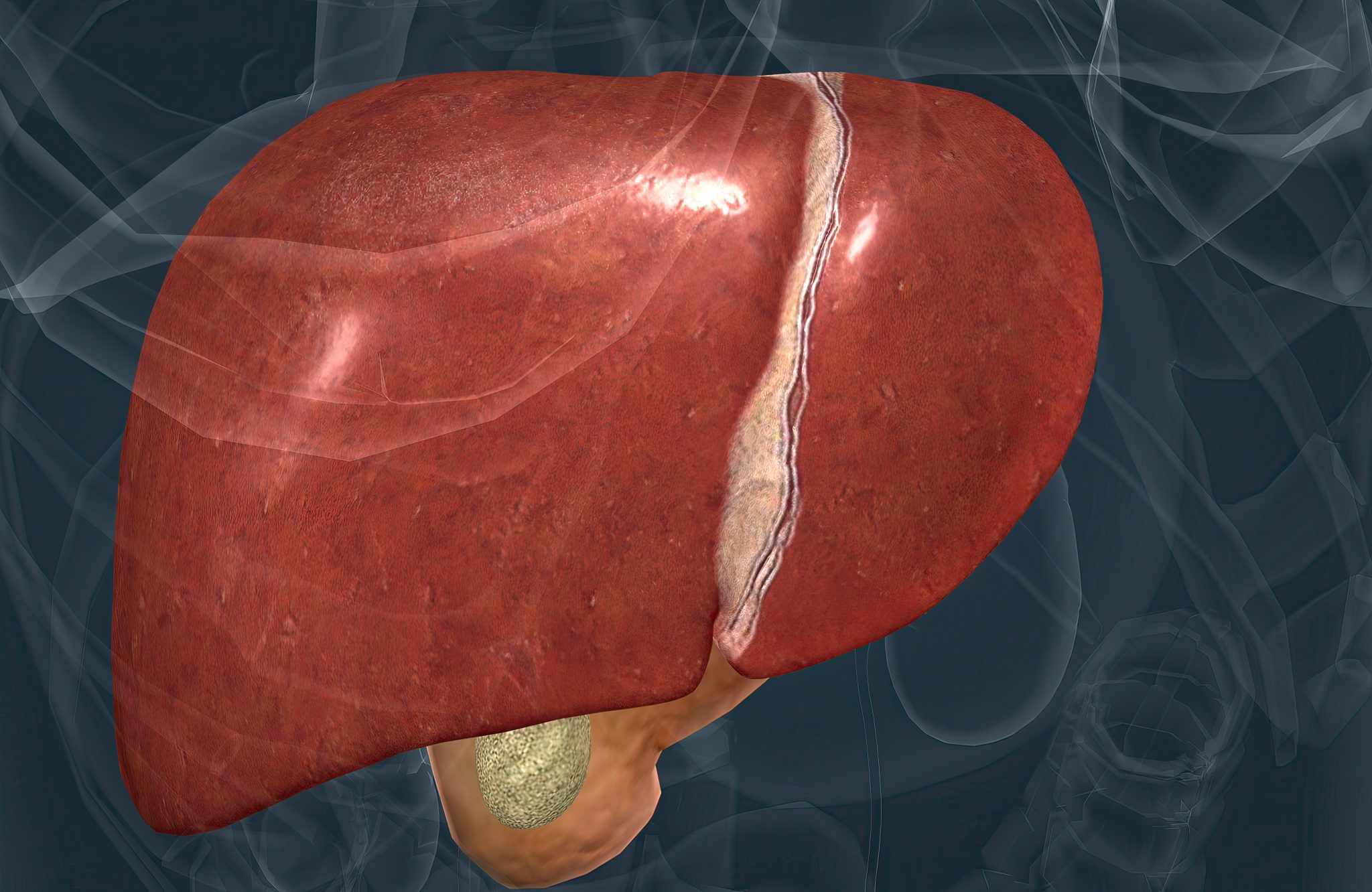 tirzepatide fatty liver 4