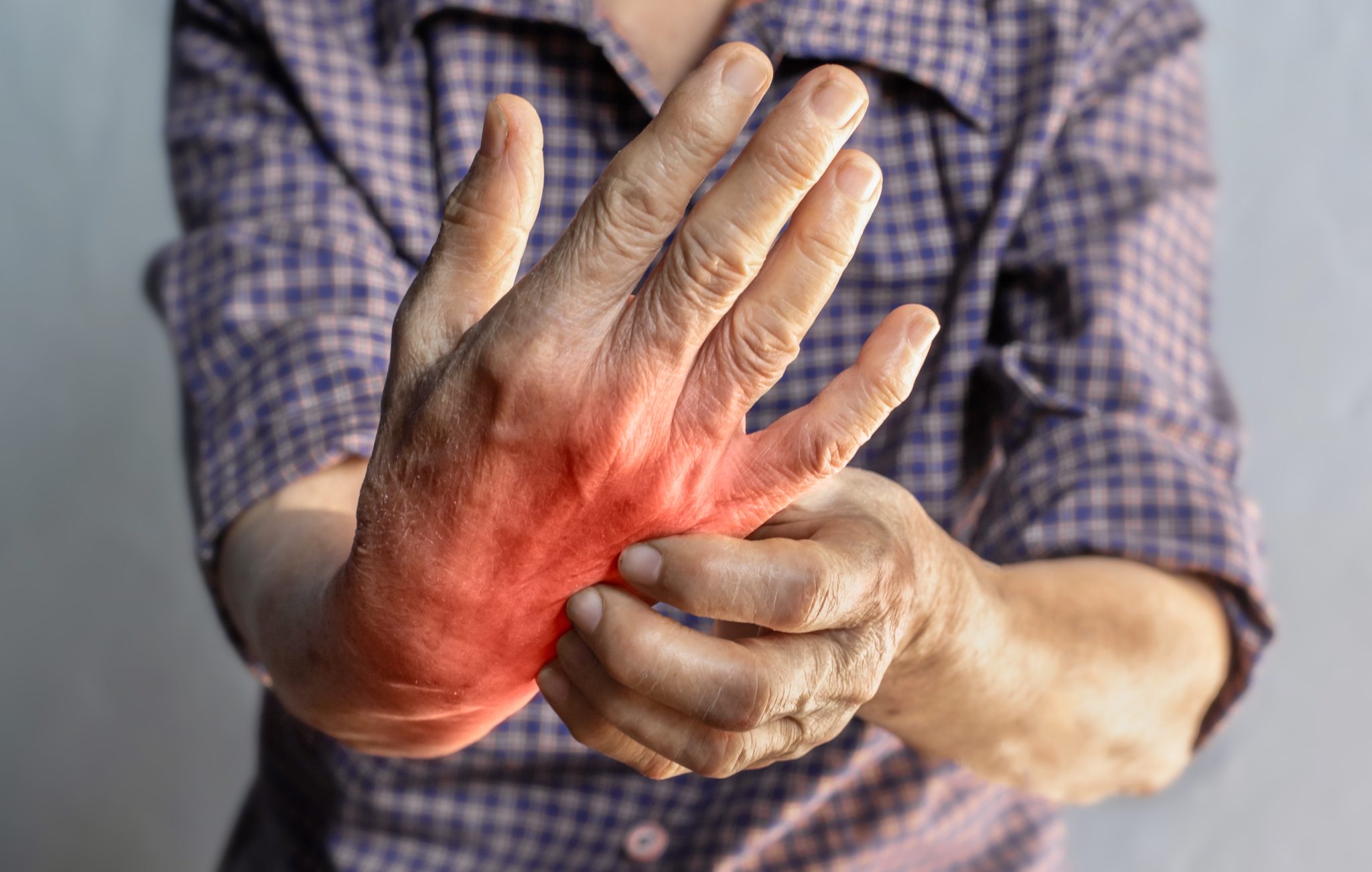 tirzepatide for rheumatoid arthritis 3