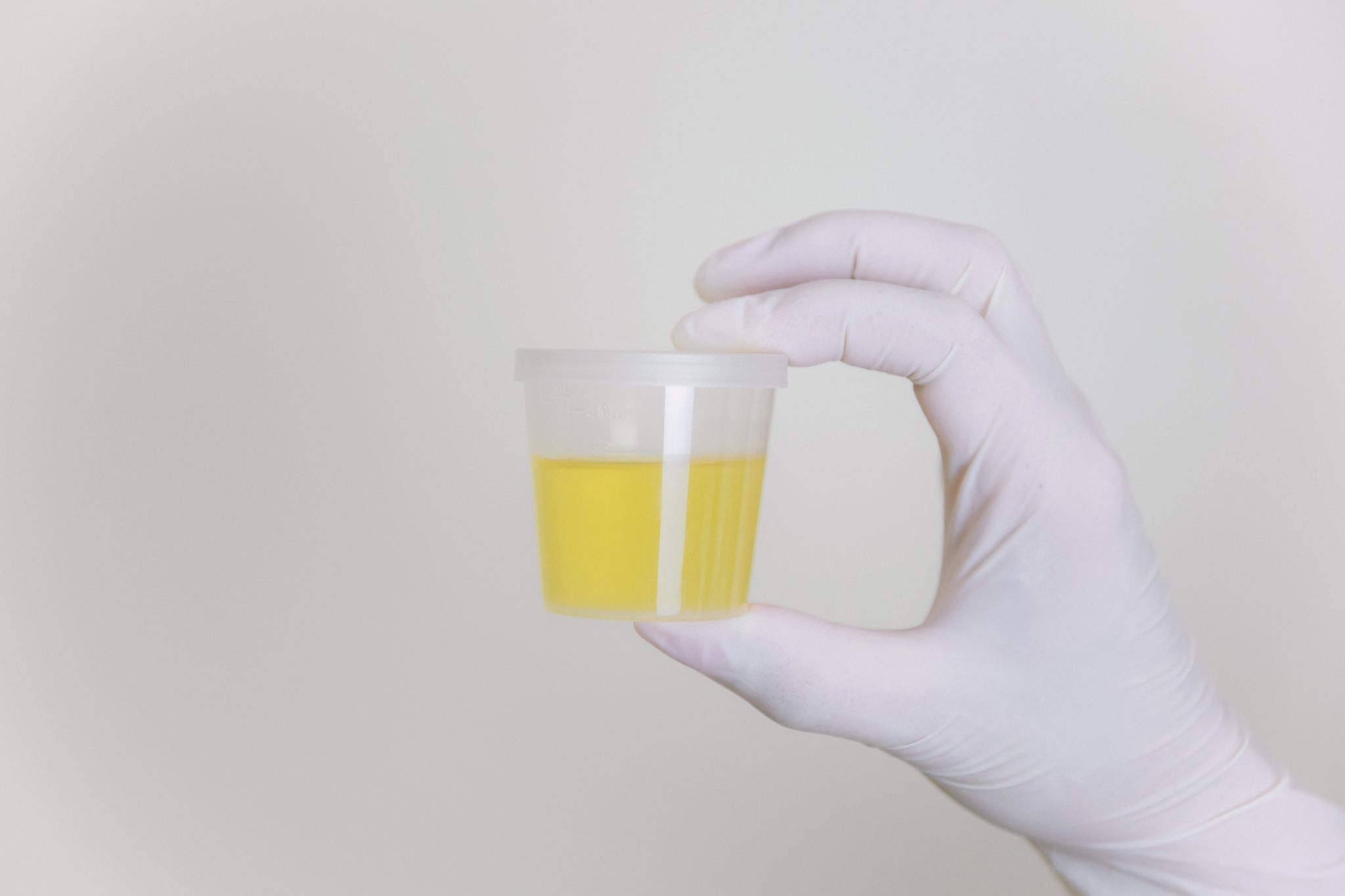 does semaglutide make urine smell Semaglutide Side Effects: Understanding Changes in Urine Smell