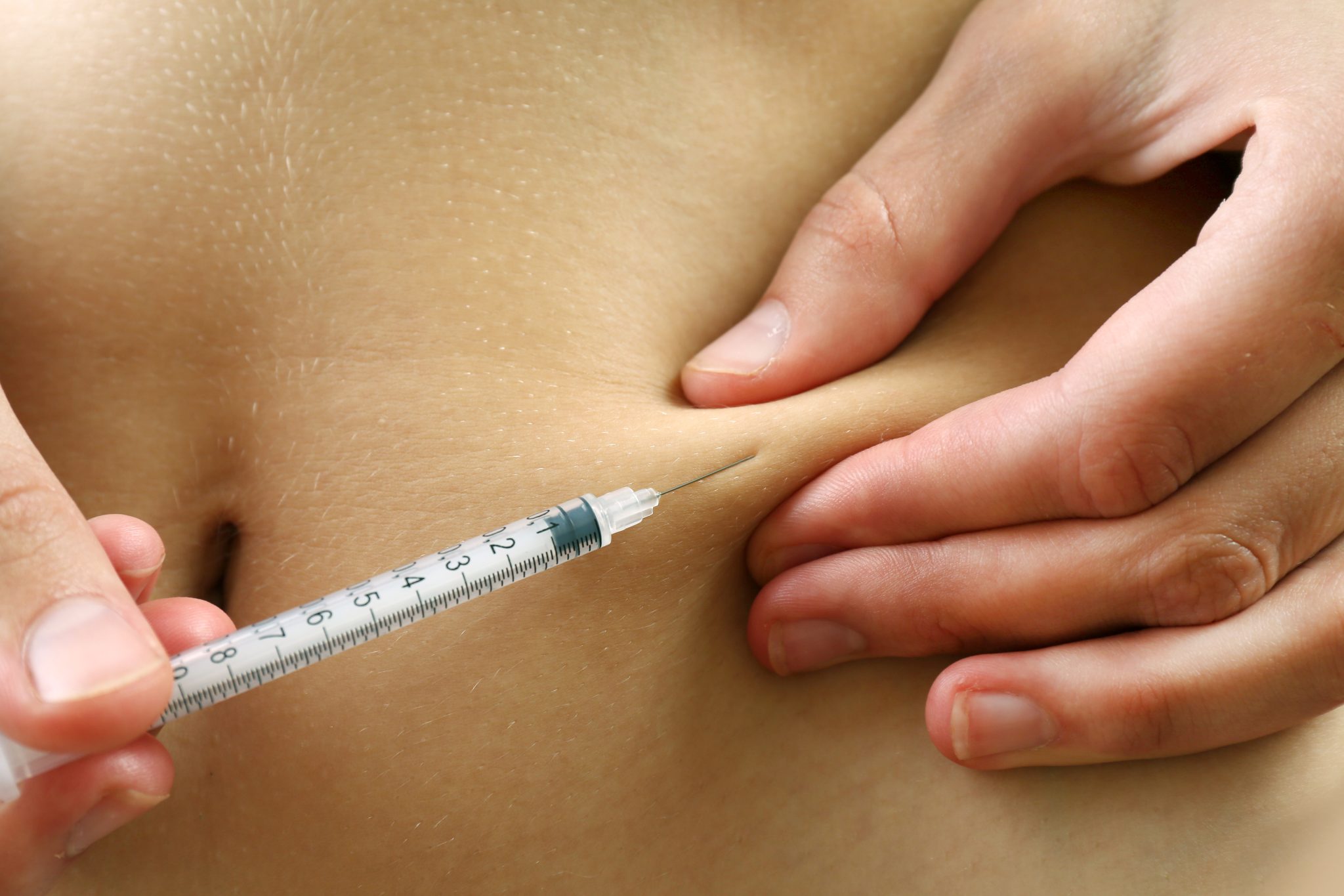 where can i inject tirzepatide 3